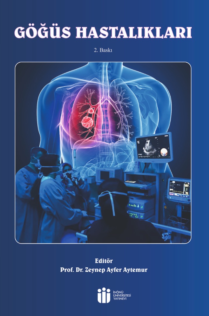 Chest Diseases, 2nd Edition