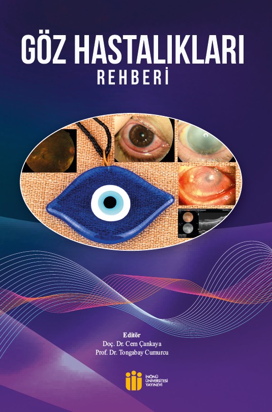 Guide to Eye Diseases